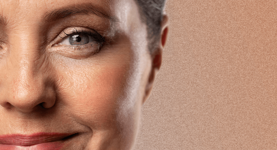 Treatment Bunny Lines Face360