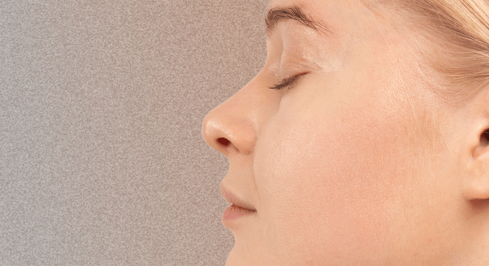Nose Tip Lift Treatment Face360