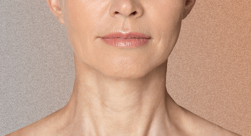 Orange Peel Chin Treatment Face360