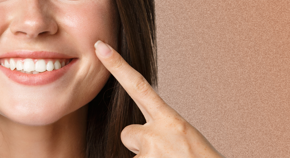 Teeth Grinding Treatment Face360