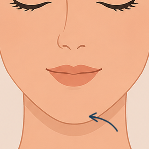Chin Face360 Treatment Illustration