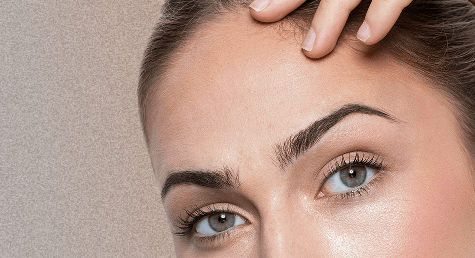 Treatments Brow Lift-face360